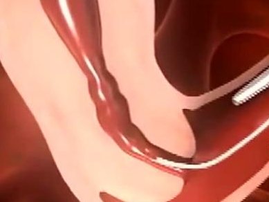 试管胚胎和内膜都很好的情况下不着床和生化哪个更可怕？