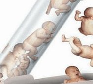 去泰国做试管多少钱？需要准备哪些资料？