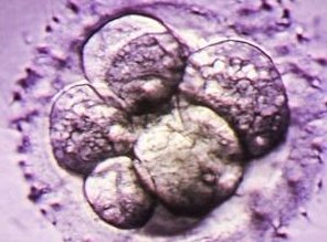 为什么选择去美国生孩子？第三代试管婴儿成功率高吗？